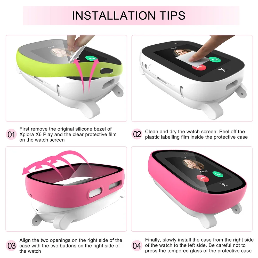 เคสสำหรับ xploar X6 Play อุปกร - Smart Watch Kids บทวิจารณ์และราคา